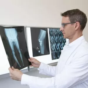 Rehabilitácia po výmene kolena doma: cvičenia a odporúčania na zotavenie