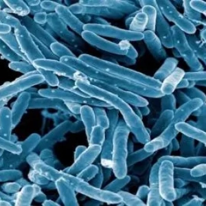 Sekundárna tuberkulóza: formy, príčiny, symptómy, diagnostika a liečba